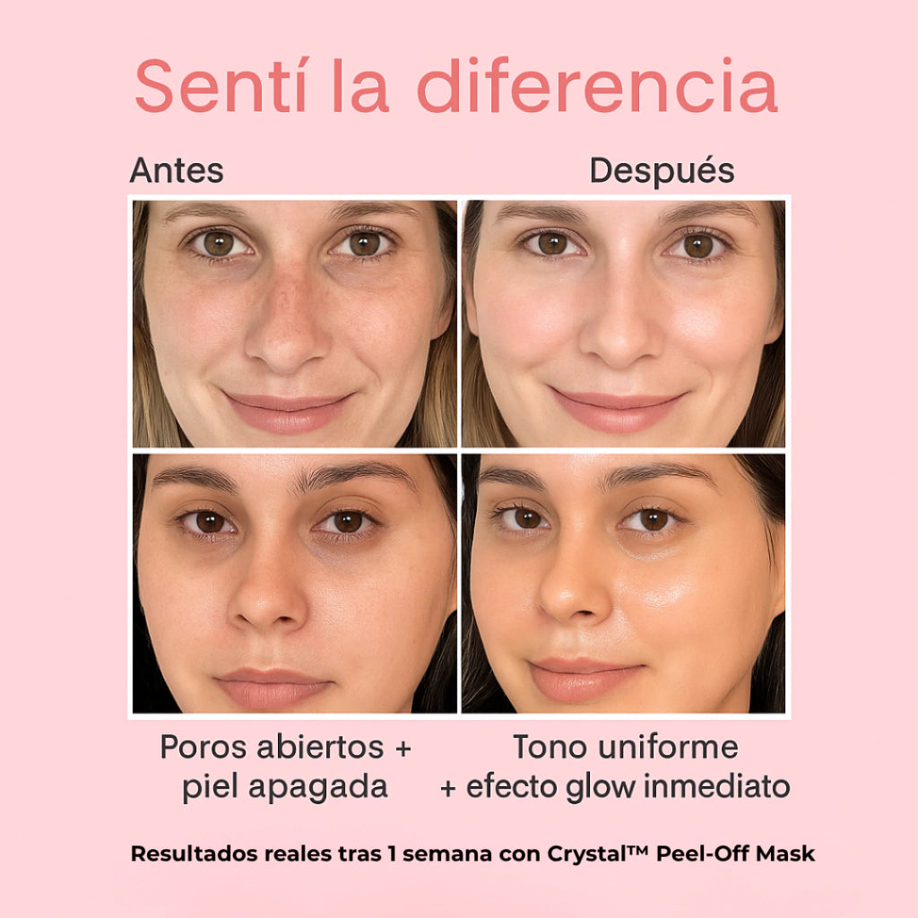 CRYSTAL™ – Mascarilla Facial Peel-Off Transparente | PREVENTA