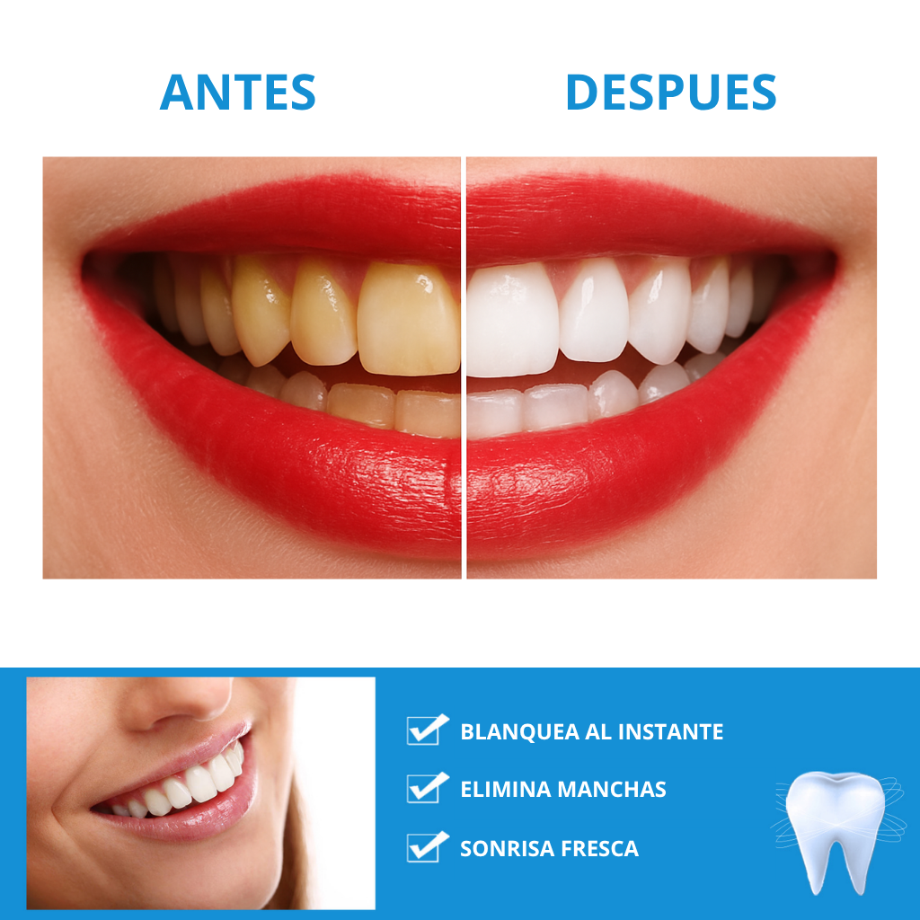 WhitePen™ — Lápiz blanqueador dental | Sonrisa radiante desde el primer uso