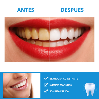 WhitePen™ — Lápiz blanqueador dental | Sonrisa radiante desde el primer uso
