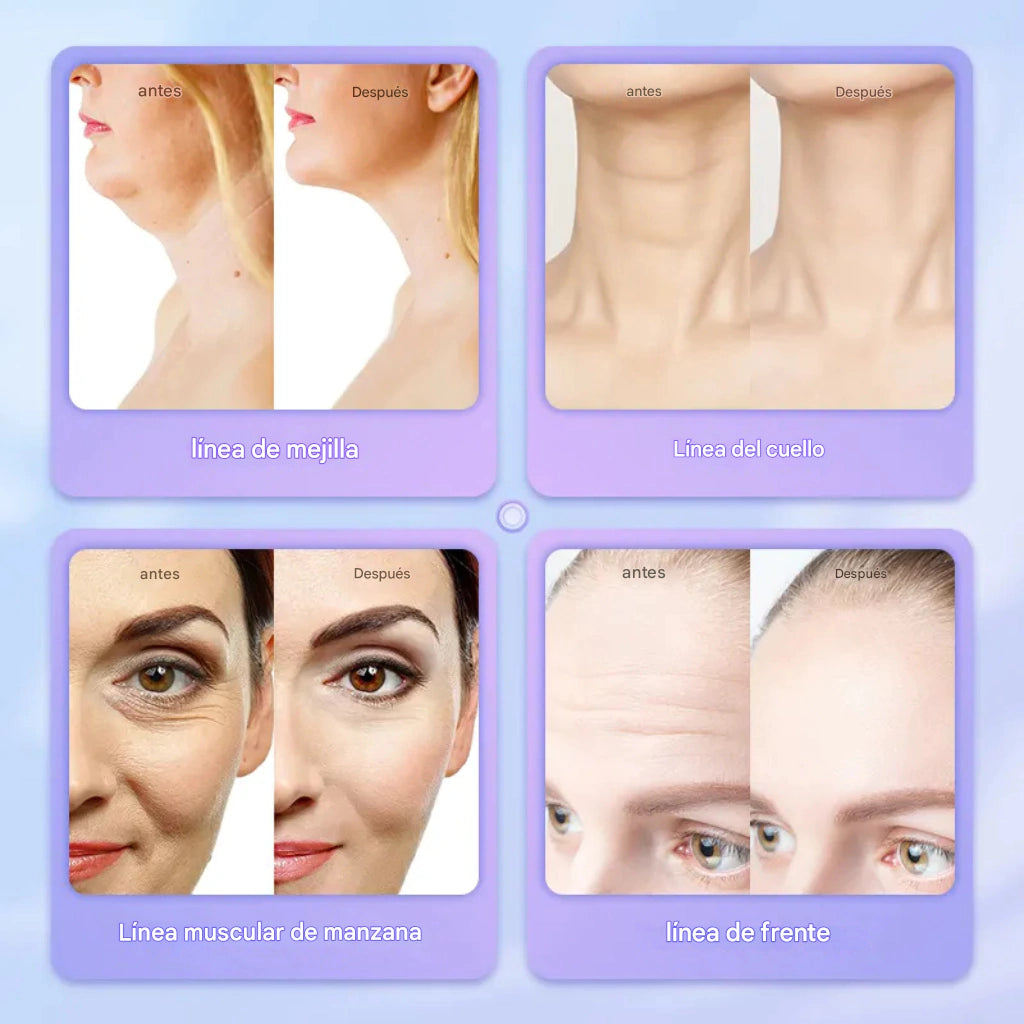 PowerLift™ 7 - Masajeador Facial EMS con 7 Luces LED y Reductor de Papada + Sérum