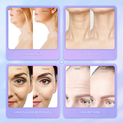 PowerLift™ 7 - Masajeador Facial EMS con 7 Luces LED y Reductor de Papada + Sérum